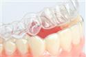 Ordinacija dentalne medicine mr.sc. lada hemerich martinčić dr.med.dent 7