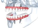 Centar dentalne medicine centrodent rijeka 6