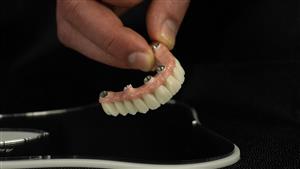 CENTRODENT - stomatološka ordinacija - Rijeka ALL ON 4