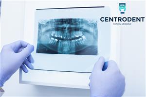 Centar dentalne medicine CentroDENT Rijeka ORTOPAN