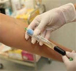 MEDICINSKO-BIOKEMIJSKI LABORATORIJ SUZANA LJUBEJ mag.med.biochem. VAĐENJE KRVI