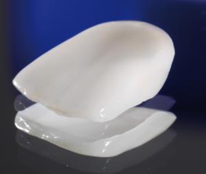 CENTRODENT - stomatološka ordinacija - Rijeka ZUBNE LJUSKICE