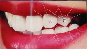 DentalTime d.o.o. za zdravstvenu djelatnost dentalne medicine ZUBNI NAKIT